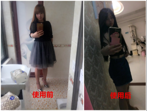 ‘开云入口’祛斑胶囊有哪些优点?(图1) 开云赛事